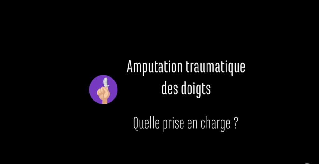 Amputation traumatique des doigts