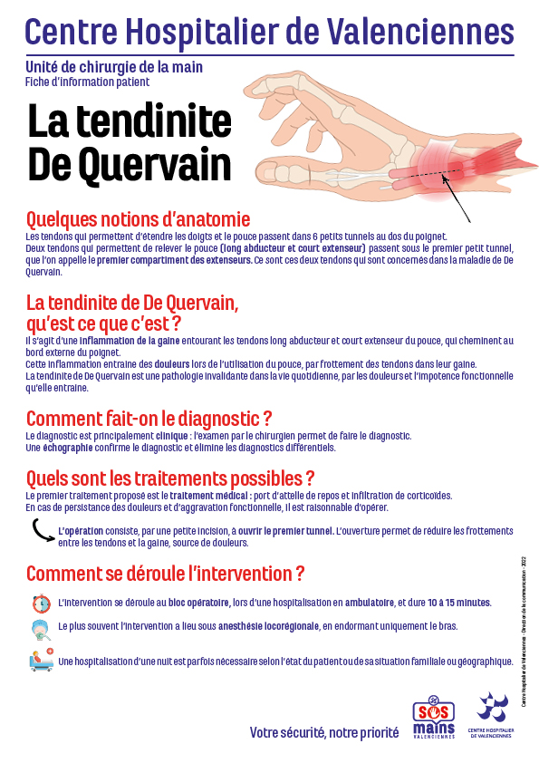 Tendinite de De Quervain