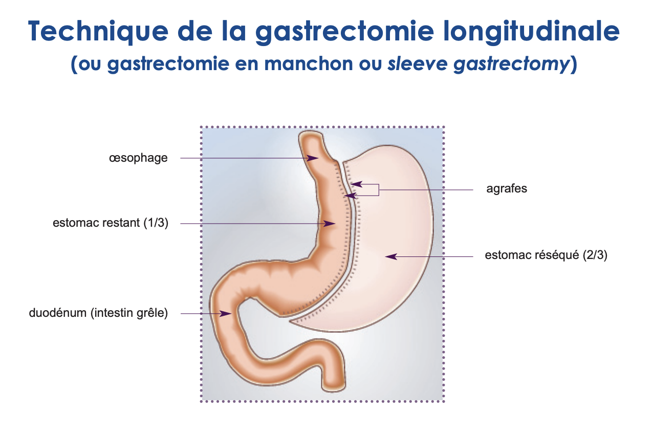 Capture d’écran 2024-01-16 à 10.27.36