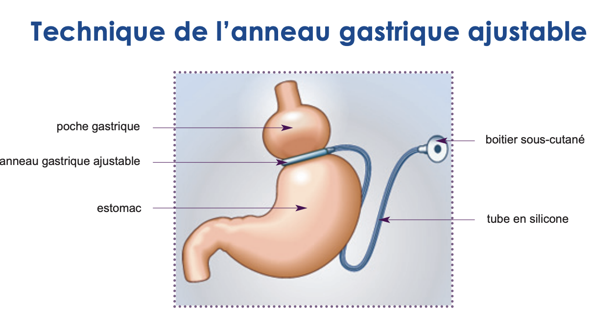 Capture d’écran 2024-01-16 à 10.46.24